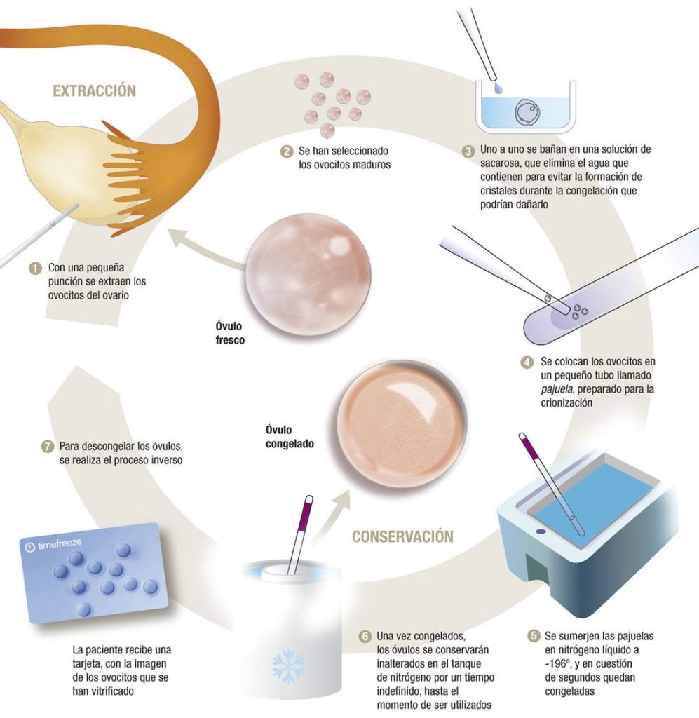 vitrificacion_de_ovulos-1